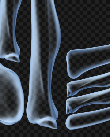 Letter L from X-ray Bones Font on Yellow Images Creative Fonts - S38625