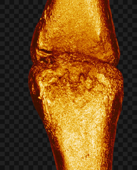 Letter i from Golden bones alphabet on Yellow Images Creative Fonts - S49564