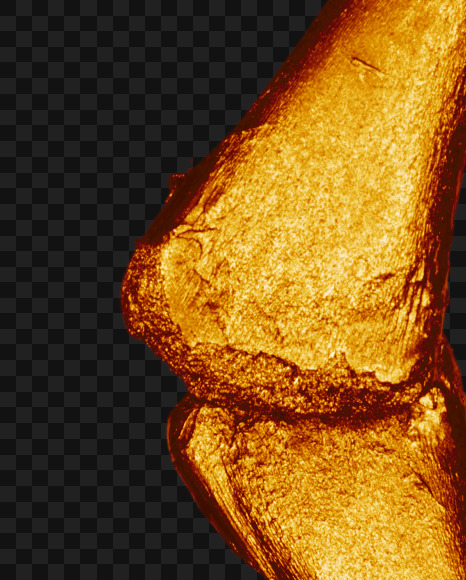 Letter c from Golden bones alphabet on Yellow Images Creative Fonts - S49558