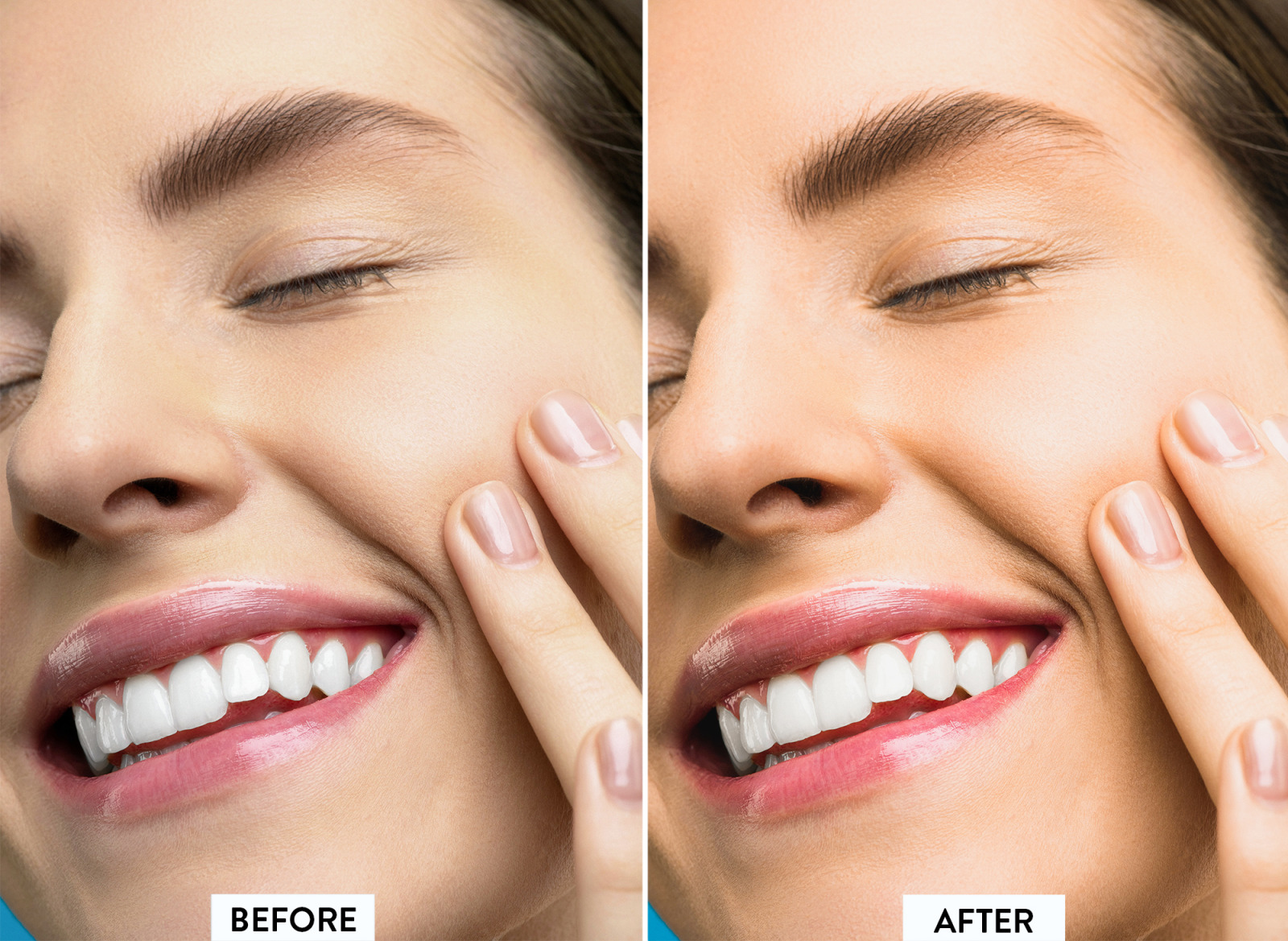 10 Perfect Skin Lightroom Preset 10 Perfect Skin Lightroom Preset